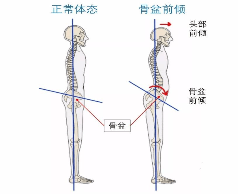 人体美学音乐诠释，谁的骨盆最端正歌曲揭秘